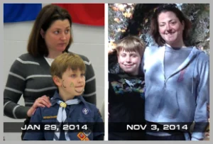 Comparison of Appearance: The 1st photo was taken on January 29, 2014. The 2nd photo was taken on November 3, 2014. photo